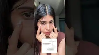 Testing Micro Needle on Under-eye Wrinkles #shorts #skincare #microneedling
