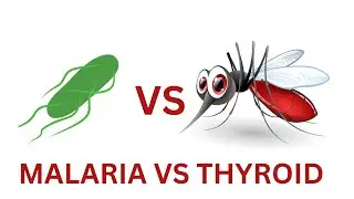 LET’s LEARN ABOUT MALARIA AND TYPHOID| mode of transmission, symptoms, diagnosis, treatment. 