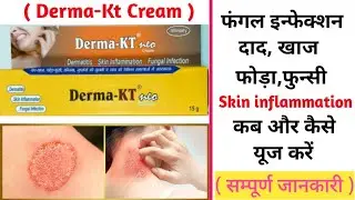Derma-Kt Cream || फंगल इन्फेक्शन दाद,खाज की सबसे शानदार दवा || Derma-Kt Neo Cream use Hindi