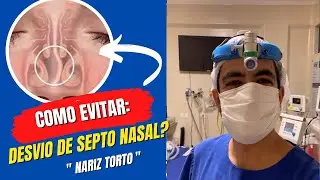 Como evitar o desvio de septo nasal, nariz torto e quebrado