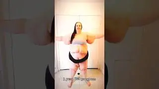 AMAZING WEIGHT LOSS TRANSFORMATION😳#shorts#weightlosstransformation#fitness#shortsfeed#short