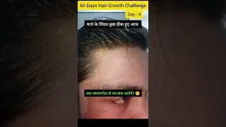 60 Days hair growth challenge Day 4 ll Jamalgota hair treatment ll jamalgota side effects #shorts