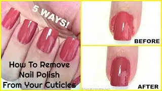 How To Remove Nail Polish From Your Cuticles Or Around The Nails! 5 WAYS