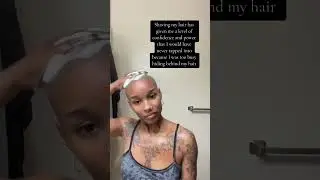 #scalp #skincare #scalpcare #bald #baldie #baldare #chidi #chiditiffany #blackowned
