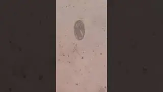 Strongyle larvae - Veterinary Video