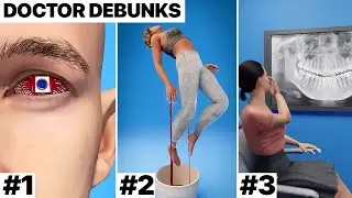 Doctor Reacts to Bizarre Medical Stories