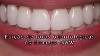 Fotografia odontológica - Editando fotos em .RAW