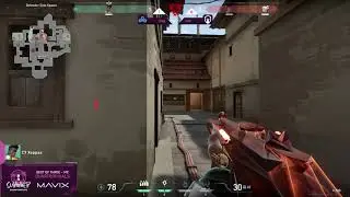 Xeppaa 1v5