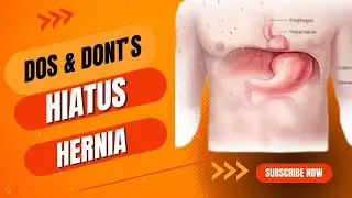 DOs & DONT&rsquo;s of Hiatus hernia | Dr Pooja Pandey  Tripathi | Arogya physiotips