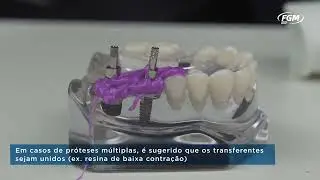 Transferentes met&aacute;licos Arcsys | Saiba + FGM