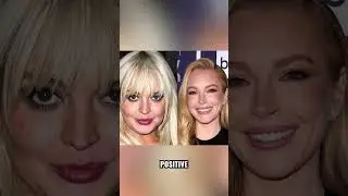 Former Disney Star Looks Different Now: An Expert Plastic Surgeon Breakdown