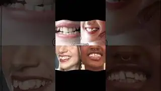 Wich smile are you #smile#indila song