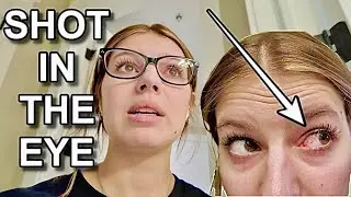 SHOT IN THE EYE with a NERF GUN: Temporarilly BLINDED!!!