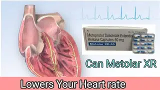 Use Metolar XR to lower your heart beat