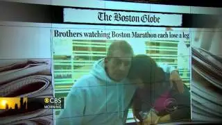 Brothers each lose leg watching Boston Marathon