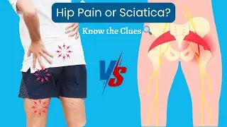 Is It Hip Pain or Sciatica? How to Tell the Difference