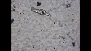Rotifer Bdelloidea in movement