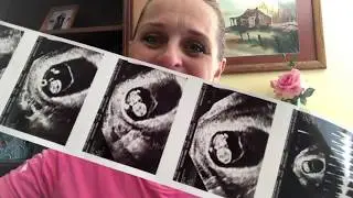 46 & Pregnant w Baby #13//Week 12//What The....!