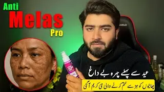 A New Cream For Melasma And Pigmenation - ANTI MELAS PRO
