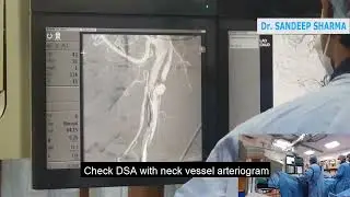 TIGHT CAROTID STENTING