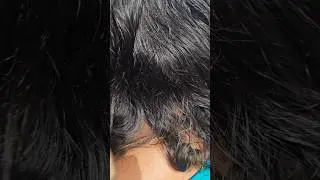 lice Removal Treatment service #lovelybeautyparlour #liceremoval #liceremovaltreatment