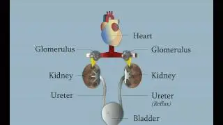 Vesicoureteral Reflux