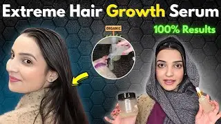 Fast Hair Growth Serum 🚀 Regrow Hair Naturally at Home | Stop Hair Fall