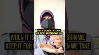 Hijama According to Sunnah: Reviving the Prophetic Practice