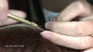 Hair Ventilation Close-Up