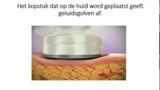 cavitatie
