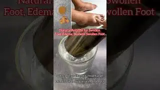 Natural Remedies For Swollen Feet/Edema Diabetes Foot