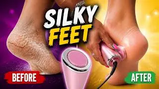 Transform Your Feet with the Viral Electric Callus Remover! | Real Review & Results!