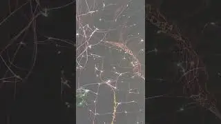A vibrant, glowing representation of a human brain with neural connections, set against a dark