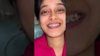 Transform Your Smile with American Brackets | Dr. Sujeet&rsquo;s Dental Care, Pune #shorts #viralshorts