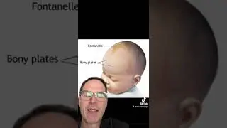 The anterior fontanelle can tell several secrets about your baby. #pediatrics #pregnant  #nicu