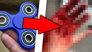 Fidget Spinner Accident!!