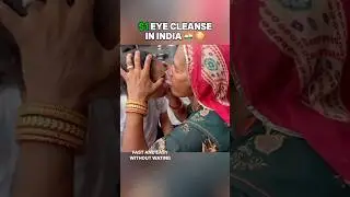 Surgery in 5 seconds😜😂 #shorts #kunalchhabhria #funny #desi #hack