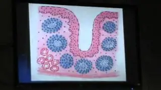 30) Dr.Gihan 03/05/2014 [Spleen - Thymus - Tonsil]