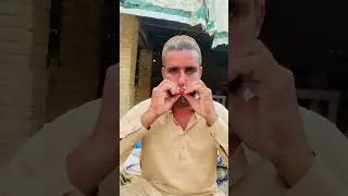ہنسی کے ساتھ صحت یابی: مزاحیہ فزیو تھراپی