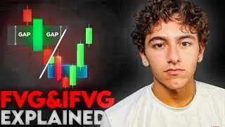 The ONLY Fair Value Gap Video You Will Ever Need