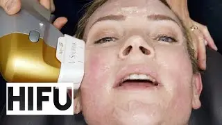 Korean Skin Clinics, Getting HIFU & BOTOX in Seoul Korea