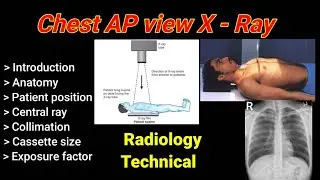 Chest AP View X-Ray # Anterior to posterior # patient position # ||  By BL Kumawat #
