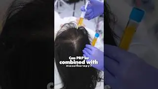Can PRP be combined with Mesotherapy? | SB Trichology | #Shorts