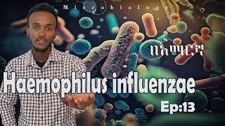Microbiology  Genus Haemophilus : Haemophilus influenzae Ep ; 13