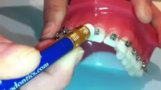 Murphy orthodontics