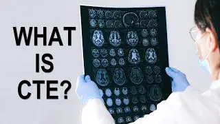 What is Chronic Traumatic Encephalopathy (CTE)?