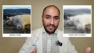 What Are Cataracts? Explained by Dr. Sinan Albear, M.D. | Ophthalmic Specialists of Michigan