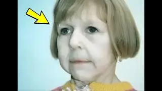 Девочка родилась с лицом бабушки! Вот как она выглядит 24 года спустя!