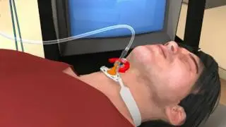 Ventrain and emergency ventilation