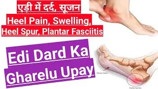Edi Dard Ka Gharelu Upay | Heel Pain Ka Ayurvedic Ilaj | Edi Ki Haddi Mein Dard Ka Ilaj